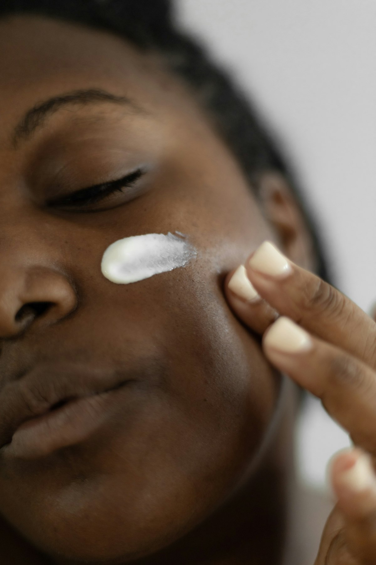 Aplicación de tratamiento dermatológico en piel